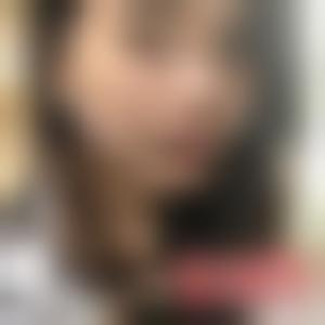 「上海首尔丽格整形美容医院张震东」怎么样?擅长|案例|价格表