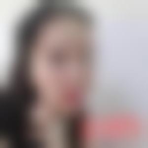 「深圳非凡整形医院丁博」怎么样?擅长|案例|价格表