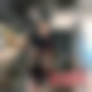 「江苏省中医院整形外科黄金龙」怎么样?擅长|案例|价格表