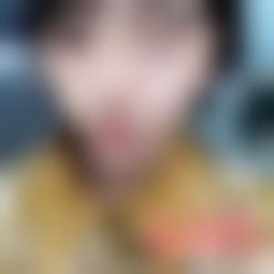 「江苏省中医院整形外科王金明」怎么样?擅长|案例|价格表