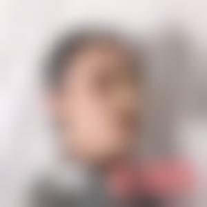 「北京知音医疗美容宋艳平」怎么样?擅长|案例|价格表