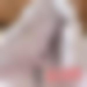 「郑州乡南整形美容医院陈乡南」怎么样?擅长|案例|价格表