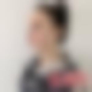 「上海一美整形外科医院邹丽剑」怎么样?擅长|案例|价格表