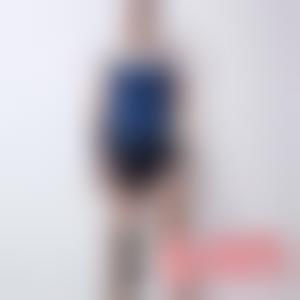 「上海一美整形外科医院黄晓娟」怎么样?擅长|案例|价格表