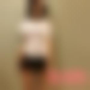 「上海一美整形外科医院吴梅」怎么样?擅长|案例|价格表