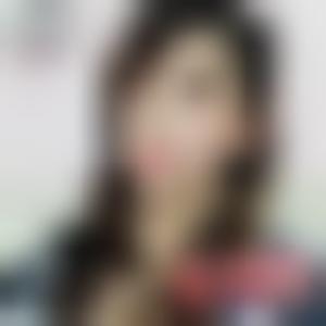 「上海一美整形外科医院王亿华」怎么样?擅长|案例|价格表