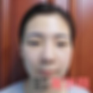 成都玉之光医疗整形医院口碑怎么样？