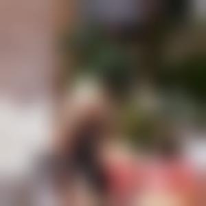 「上海华美医疗美容整形医院王荣锡」怎么样?擅长|案例|价格表