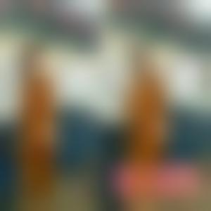 「成都八大处医疗美容整形医院」怎么样?正规吗|案例|价格表