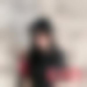 「石家庄雅芳亚医疗美容整形医院」怎么样?正规吗|案例|价格表