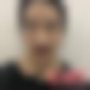 「成都八大处医疗美容整形医院靳小雷」怎么样?擅长|案例|价格表