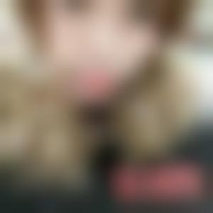 「石家庄雅芳亚医疗美容整形医院刘莎莎」怎么样?擅长|案例|价格表