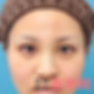 郑州华领医疗美容医院口碑怎么样？