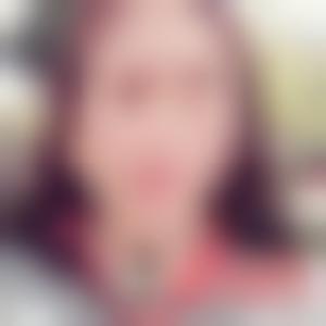 「上海韩镜医疗美容医院李相达」怎么样?擅长|案例|价格表