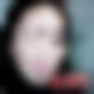 「上海韩镜医疗美容医院李相达」怎么样?擅长|案例|价格表