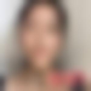 「上海韩镜医疗美容医院金志昱」怎么样?擅长|案例|价格表