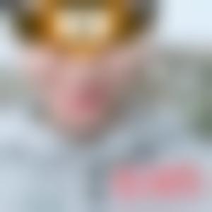 「北京八大处整形美容医院张妍」怎么样?擅长|案例|价格表