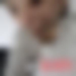 「上海薇琳医疗美容医院」怎么样?正规吗|案例|价格表||||