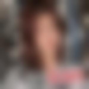 「上海真爱医疗美容医院王屏」怎么样?擅长|案例|价格表