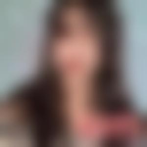 「上海真爱医疗美容医院王屏」怎么样?擅长|案例|价格表