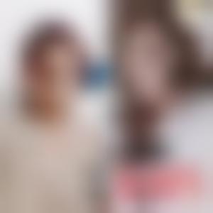 「广州华美医疗美容整形医院张明兴」怎么样?擅长|案例|价格表