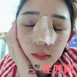 郑州菲林整形医疗美容门诊部是私立医院吗？