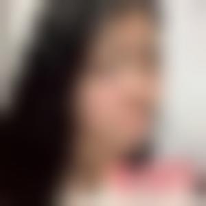 「北京壹加壹医疗美容门诊部张庆鑫」怎么样?擅长|案例|价格表