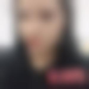 「深圳瑞芙臣医疗美容门诊部樊亮」怎么样?擅长|案例|价格表