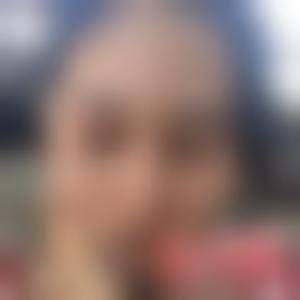 「上海美尔雅医疗美容医院徐剑炜」怎么样?擅长|案例|价格表