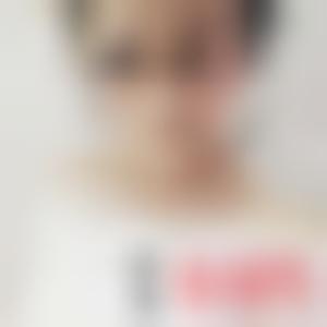 「上海美尔雅医疗美容医院李知垠」怎么样?擅长|案例|价格表