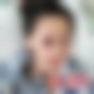 「贵州利美康整形外科医院(总院)汪国应」怎么样?擅长|案例|价格表