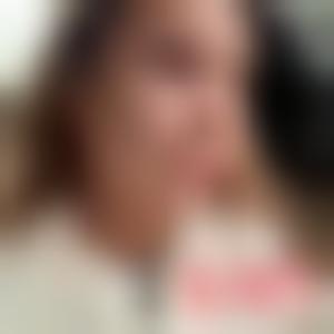「贵州利美康整形外科医院(总院)王家顺」怎么样?擅长|案例|价格表