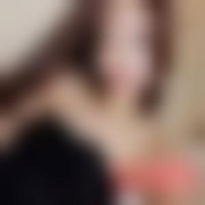 「南昌大学第二附属医院整形美容科易阳艳」怎么样?擅长|案例|价格表