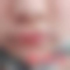 「博尔塔拉蒙古自治州人民医院整形科」怎么样?正规吗|案例|价格表