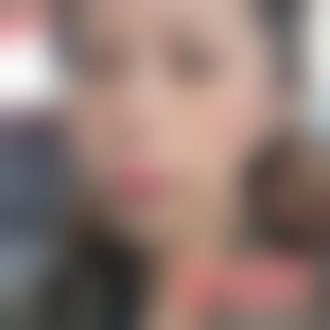 「北京润美玉之光医疗美容」怎么样?正规吗|案例|价格表