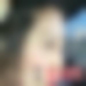 「北京润美玉之光医疗美容」怎么样?正规吗|案例|价格表