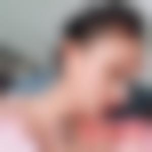 「北京协和医院整形美容科」怎么样?正规吗|案例|价格表