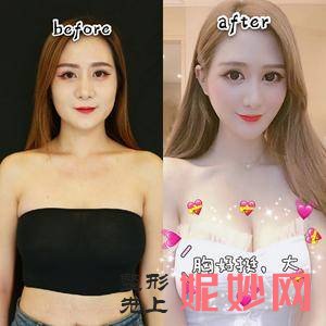 成都维度整形医疗美容（VIDO隐痕隆鼻）是私立医院吗？附2021年较新价格表