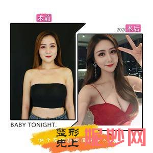 成都维度整形医疗美容（VIDO隐痕隆鼻）是私立医院吗？附2021年较新价格表