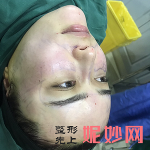 「贵阳利美康整形外科医院」怎么样?正规吗|案例|价格表