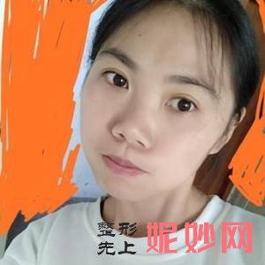 「西安未央施尔绮医疗整形医院」怎么样?正规吗|案例|价格表