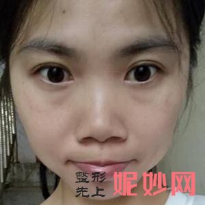 「西安未央施尔绮医疗整形医院」怎么样?正规吗|案例|价格表