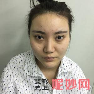 「南充阿蓝整形医院」怎么样?正规吗|案例|价格表