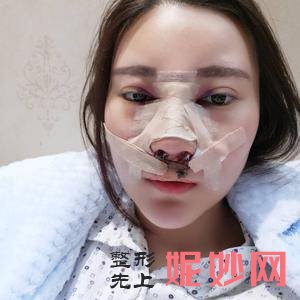 「南充阿蓝整形医院」怎么样?正规吗|案例|价格表