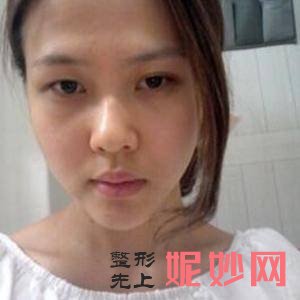 李相奇