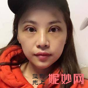 武汉美尚美医疗美容医院李相奇医生怎么样_蛋白线埋线提升颈部怎么样_坐诊时间