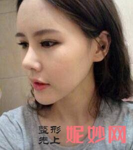 武汉美尚美医疗美容医院李相奇医生怎么样_蛋白线埋线提升颈部怎么样_坐诊时间