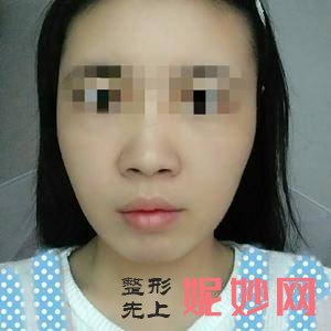 上海美莱医疗美容门诊部王琳医生怎么样_E-MAX整形怎么样