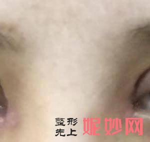 上海美莱医疗美容门诊部王琳医生怎么样_E-MAX整形怎么样