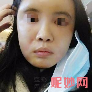 上海美莱医疗美容门诊部王琳医生怎么样_E-MAX整形怎么样